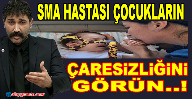 SMA HASTASI ÇOCUKLARIN  ÇARESİZLİĞİNİ GÖRÜN..!