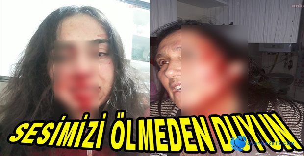 ANNE KIZDAN YARDIM ÇIĞLIĞI